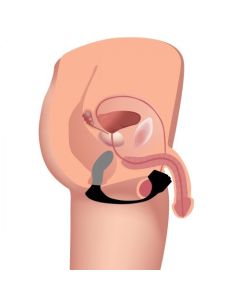 Tapón de próstata de silicona 7X control remoto - AG913 - Alternate View